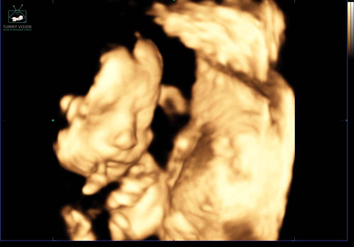 Baby Update