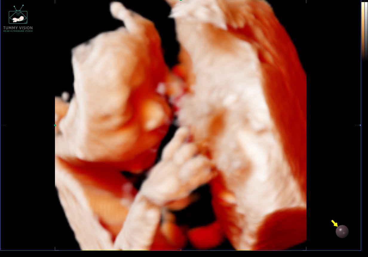 Baby Update