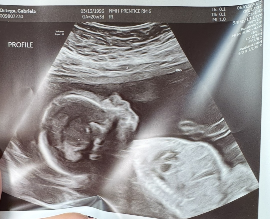 Baby Update